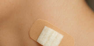 Πώς να Αφαιρέσετε ένα Θήλωμα Φυσικά στο Σπίτι με Φλούδα Μπανάνας Κοντινή φωτογραφία που δείχνει ένα κομμάτι φλούδας μπανάνας τοποθετημένο πάνω σε ένα θήλωμα στο δέρμα, στερεωμένο με επίδεσμο, ως φυσική θεραπεία