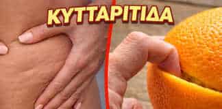 Ζάχαρη, αλάτι και αλκοόλ — τροφές που προκαλούν κυτταρίτιδα και κατακράτηση νερού